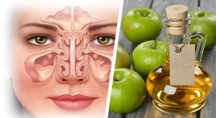 Esta simple técnica te quita la sinusitis para siempre en 30 segundos