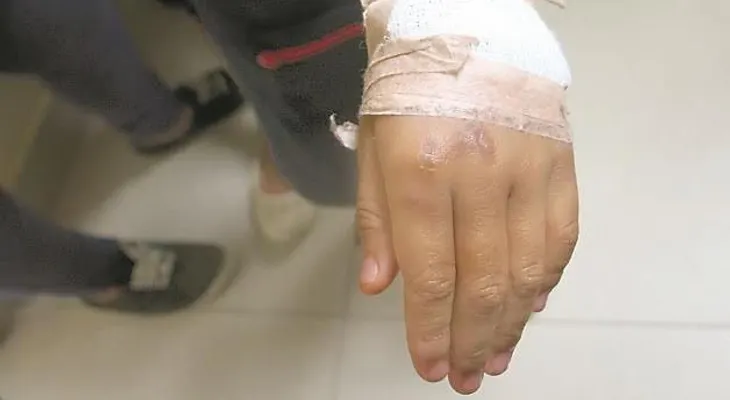 "Te voy a quemar las manos para que no vuelva a coger lo que no es tuyo", le dijo la madre enfurecida a su hijo 11 años 
