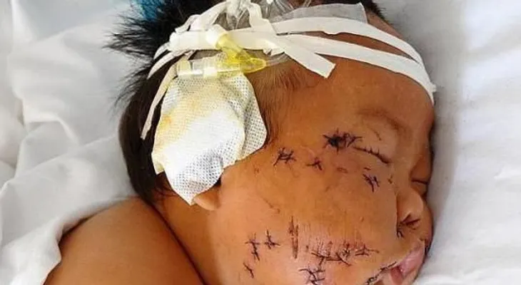 "El Mundo Llora: Apuñala su bebé porque le mordió un pezón al amamantarle