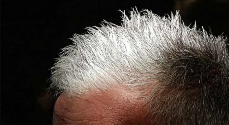 4 métodos naturales para combatir las canas