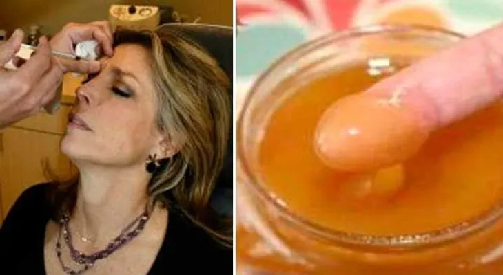 Olvídate del Botox y elimina todas tus arrugas con esta simple mascarilla de 2 ingredientes