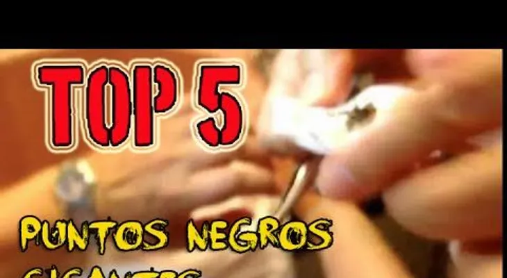 Tenía más de 10 años con un punto negro GIGANTE en la oreja y se imaginó lo que saldría de AHI