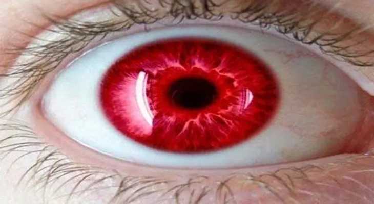 5 ojos más raros del mundo y son muy hermosos