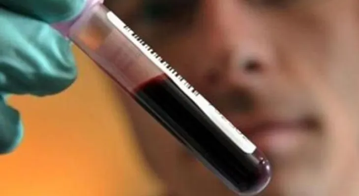 Conocer la hemofilia es vital para el manejo del paciente