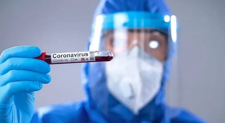 República Dominicana llega a 1,328 fallecidos por coronavirus y 80,000 contagios 