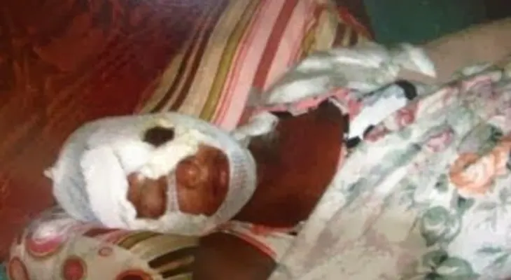 Prisión a dos hombres acusados de lanzar "ácido del diablo" en el rostro de una mujer