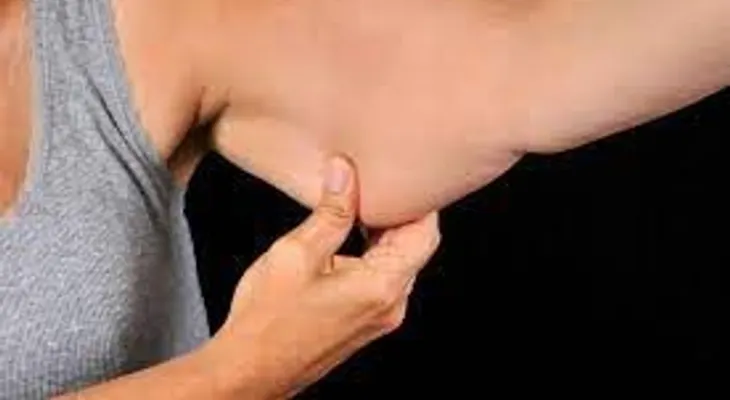 Un remedio efectivo que elimina flacidez de los brazos sin cirugía