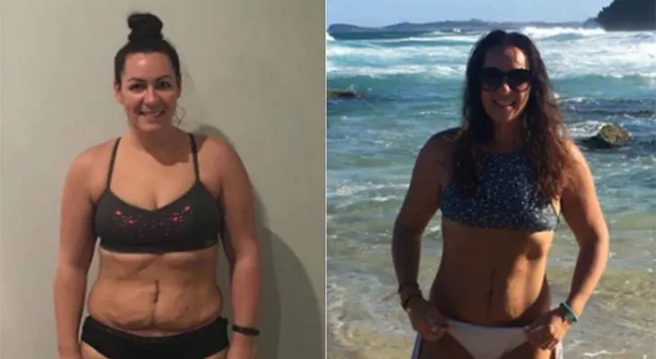 La furia contra Cosmopolitan por un brutal artículo que mezcló cáncer con dietas