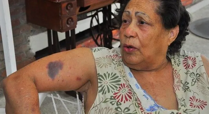 Matan vigilante y agreden señora en Rafey