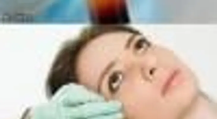 Polémica por un tratamiento estético experimental con sangre.
