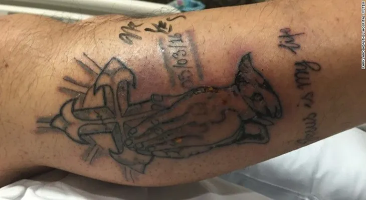 El extraño caso del hombre que murió por nadar poco después de hacerse un tatuaje
