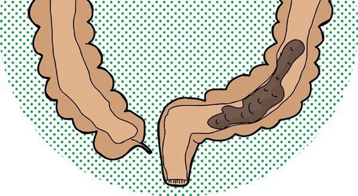Eliminar exceso de heces en el intestino con vinagre y miel
