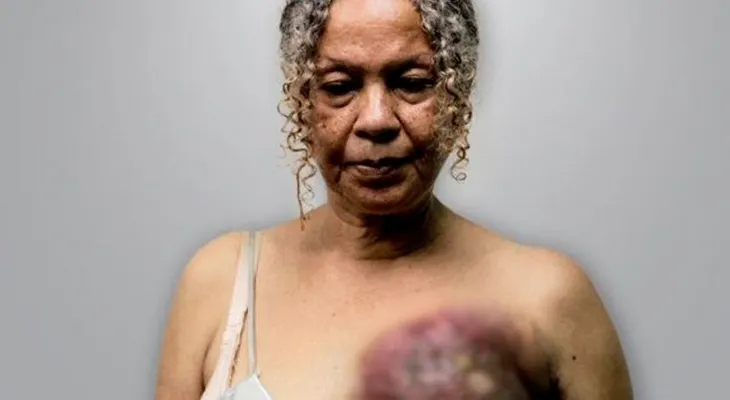 Venezuela está conmovida con el cáncer de seno de Elizabeth Salazar