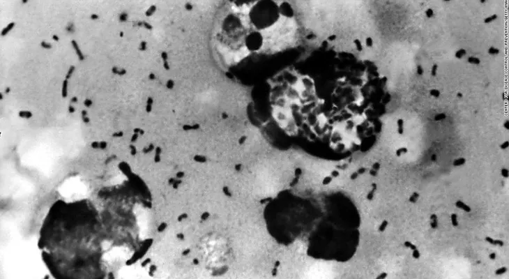 Investigan posible mal manejo de muestras de peste bubónica en laboratorios militares de EE.UU.
