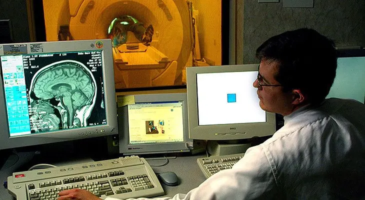 ¿Una cura para el Alzheimer? Preparan la primera vacuna que detiene su progreso