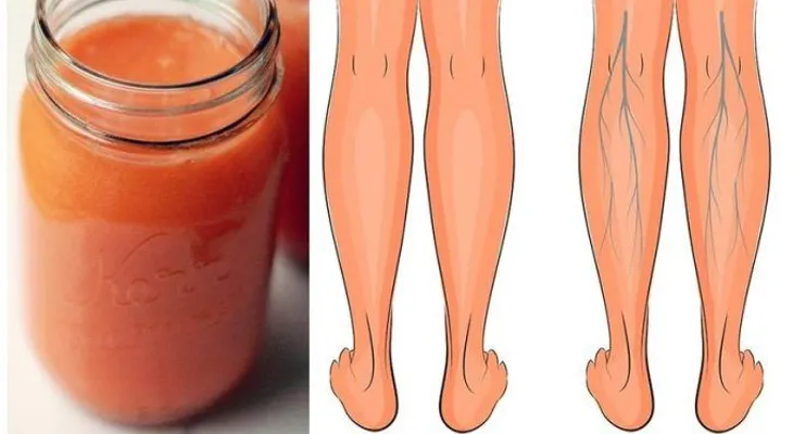 ¿Mala circulación y pies hinchados? Este batido ayudó mi abuelita de tanto lidiar con ello