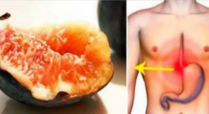 La gastritis acabó con mí estómago y flora intestinal, con este remedio me curé de ella