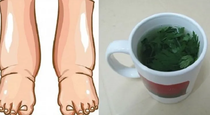 El mejor remedio para las piernas hinchadas con este té