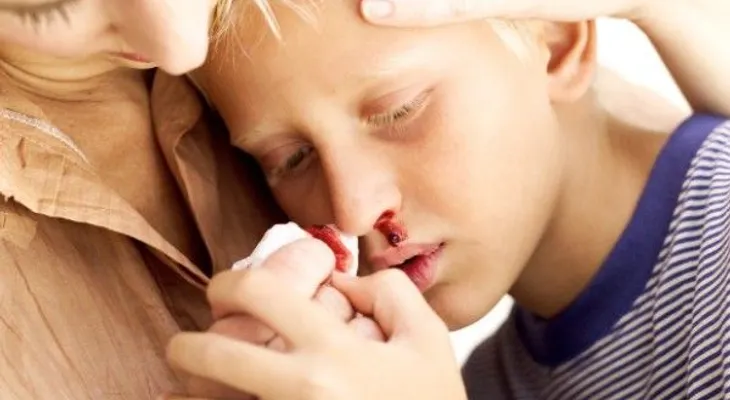 Orientación psicológica oportuna vital para paciente con hemofilia
