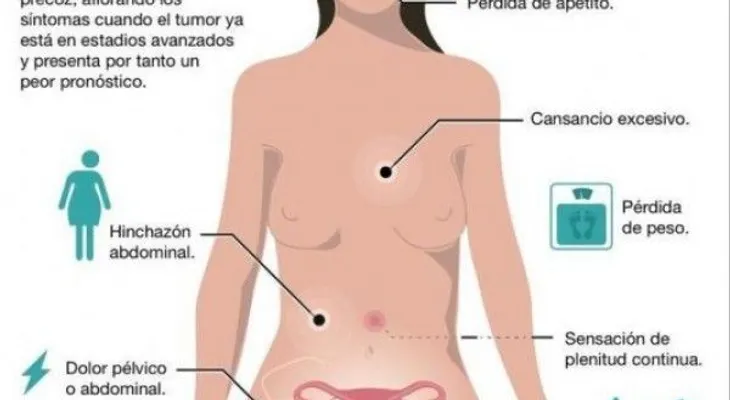 Descubren papel de dos genes en áncer de ovario más agresivo