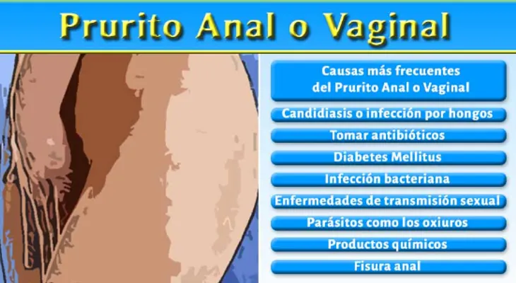 Prurito anal o vaginal afecta el 1.5% de la población mundial