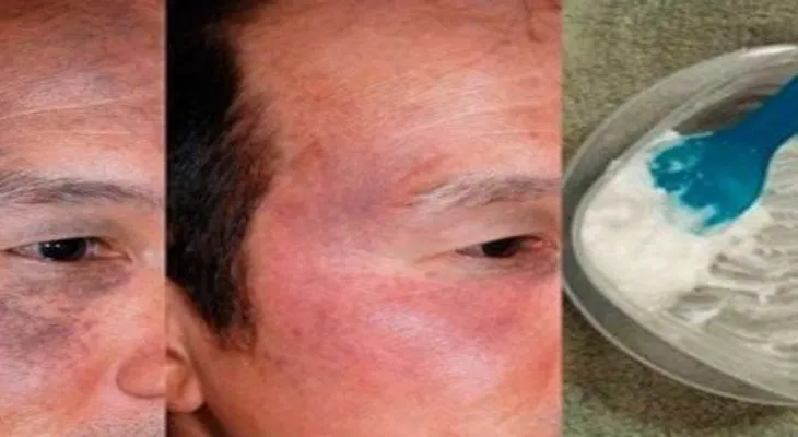 Para para verte joven en minutos: bicarbonato y aceite de coco; por qué no me lo dijeron antes