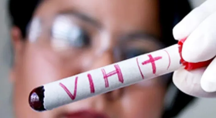 Investigadores encuentran nuevas claves para la curación del VIH