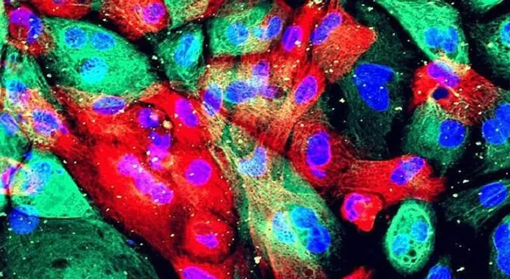 Los casos de cáncer podrían casi duplicarse en 20 años