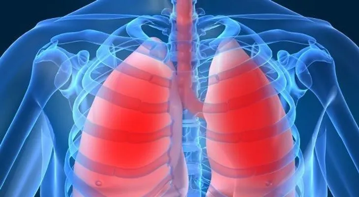  Uso de drogas inhaladas o fumadas puede provocar neumonitis química 