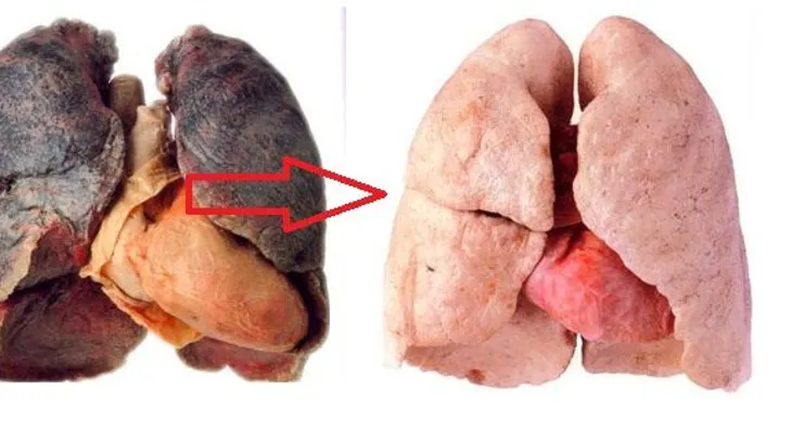 Toma este elixir y limpia tus pulmones cada día hasta dejar el cigarrillo. Los doctores nunca te lo iban a decir