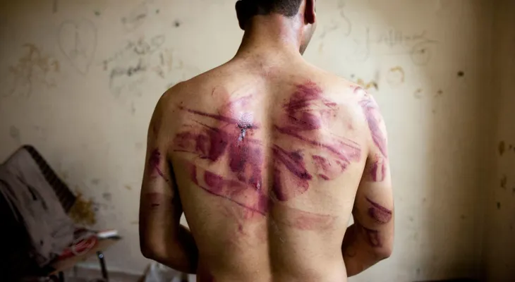 Los crímenes de guerra contra prisioneros son universales en Siria, dice la ONU