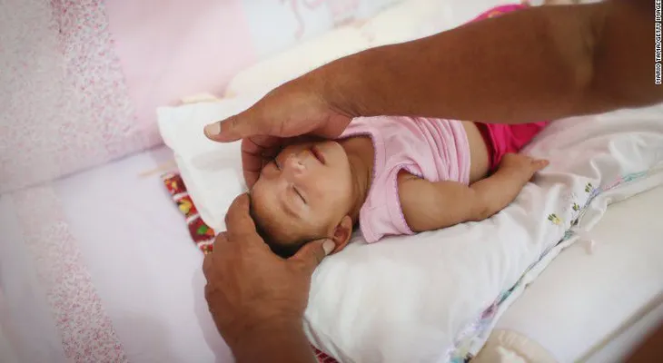 El virus del zika: director explica lo que los CDC de EE.UU. están haciendo
