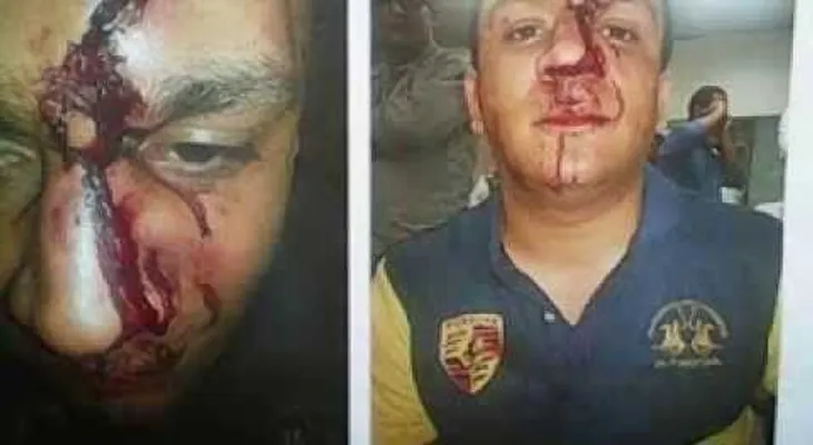 Cristian Casablanca le rompe la cara a joven y es apresado (Video)