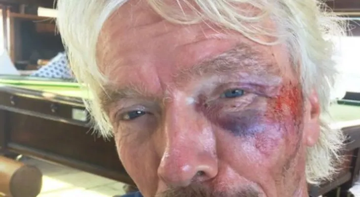 Al borde de la muerte el "mejor jefe del mundo" 