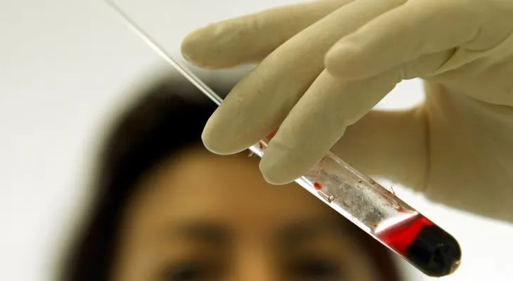 ¿Cómo un laboratorio médico arruinó durante décadas la vida de miles de personas?