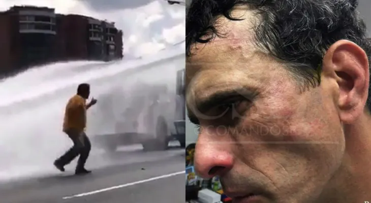 Capriles y el diputado Paparoni, heridos en Venezuela