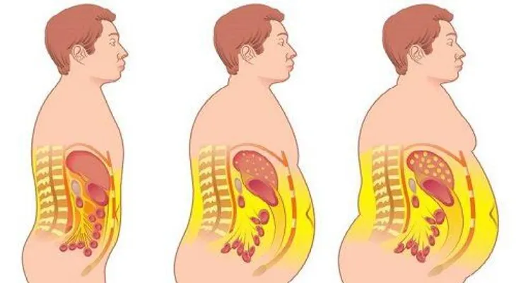 Cómo perder grasa del vientre sin hacer ejercicio