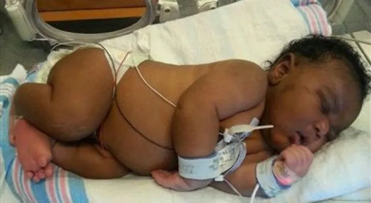 Mujer en Florida da a luz a bebé de 14 libras