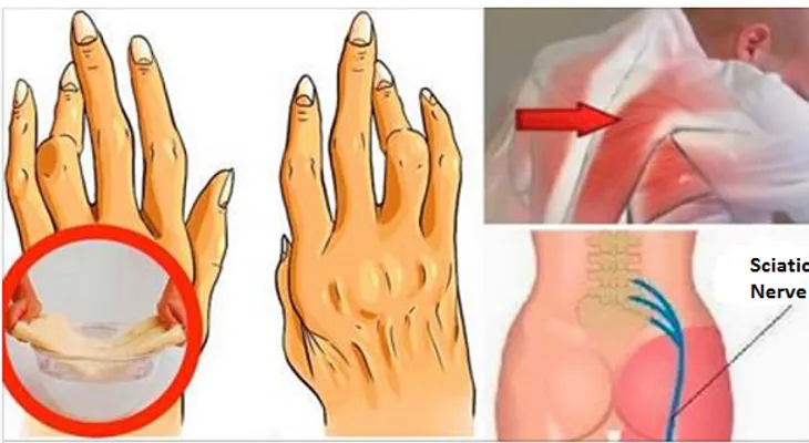 Truco super simple para combatir la artritis, dolor de espalda y ciática sin tomar píldoras
