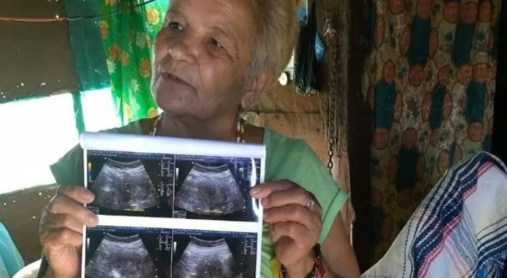 Una mujer de 70 años muestra análisis médico de su embarazo; sería la más vieja del mundo en procrear