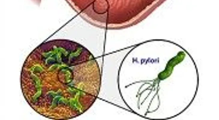 Médico japonés revela el mejor remedio para eliminar el Helicobacter Pylori, con 1 brócoli, sal marina y agua