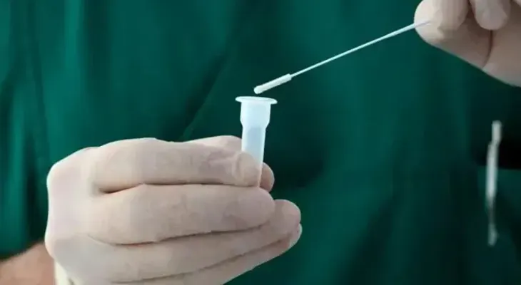 OMS: reducir las pruebas Covid complica seguimiento de pandemia