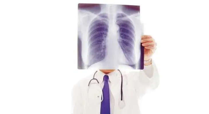 Edema pulmonar, líquido en los pulmones que puede costar la vida (VIDEO)