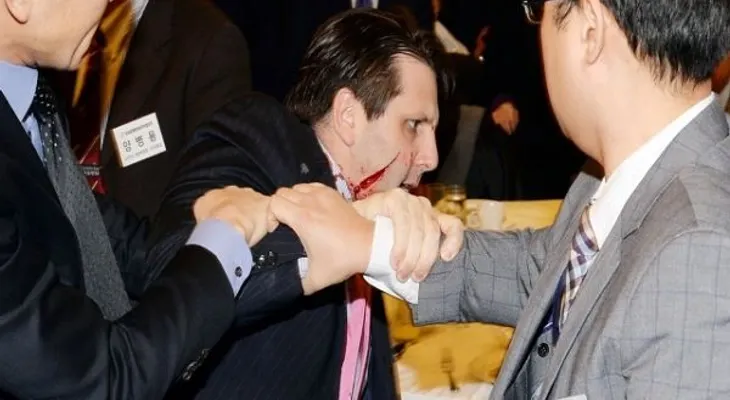 Atacan con una navaja a embajador de EEUU en Corea del Sur 