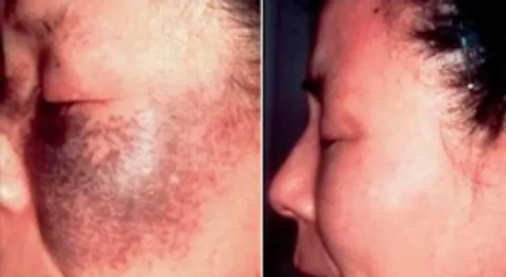 Frotalo en tu piel y en solo 72 horas será suficiente para hacer desaparecer las manches, pecas y arrugas