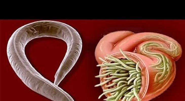 10 trucos para saber si tiene amebas o parásitos en el cuerpo y cómo eliminarlos 