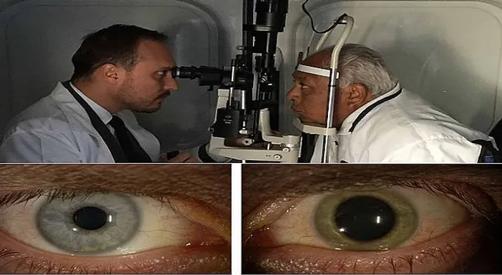 Un anciano de 90 años y casi ciego le dice al Dr. que recuperó la vista un 100% con esta receta 