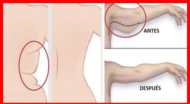 Con café y alcanfor elimina para toda la vida, la flacidez de los brazos. Remedio efectivo en mujeres y hombres 