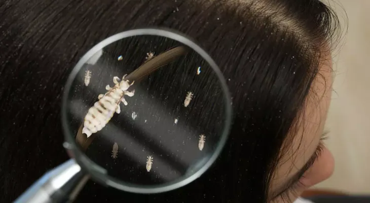 Los piojos del cuerpo humano son causante de la peste