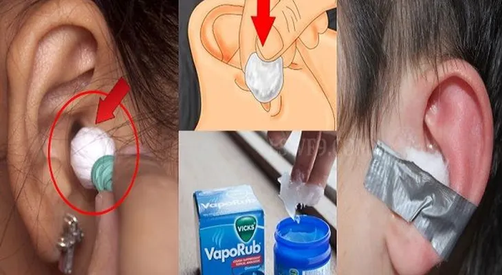 Ella pone Vick Vaporub en una bola de algodón y lo pega en su oido: Momentos después  ¡INCREÍBLE!